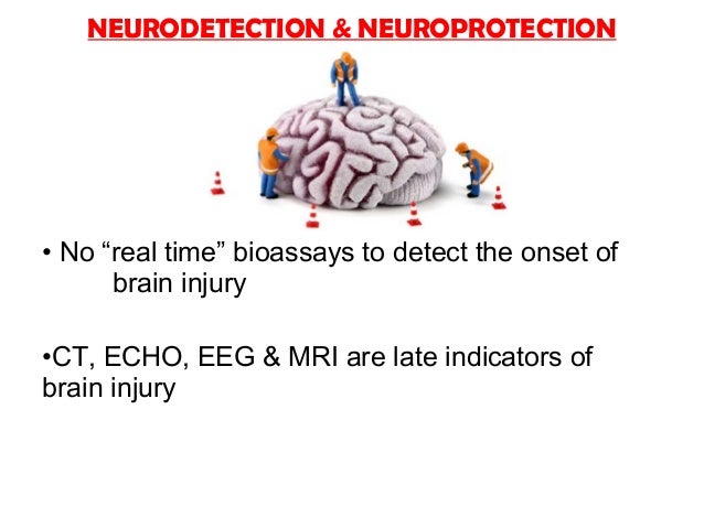 Brain Protection in Cardiac Surgery